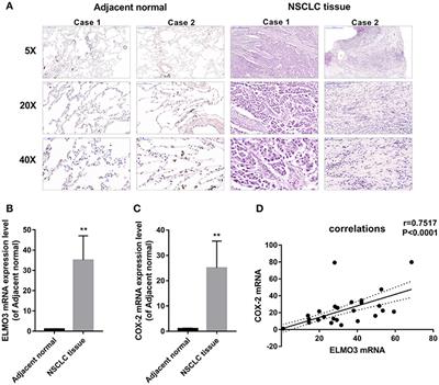 Down Regulation of the Expression of ELMO3 by COX2 Inhibitor Suppresses Tumor Growth and Metastasis in Non-Small-Cell Lung Cancer